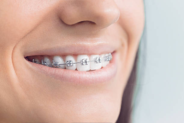 Best Dental Implants  in Wolcottville, IN